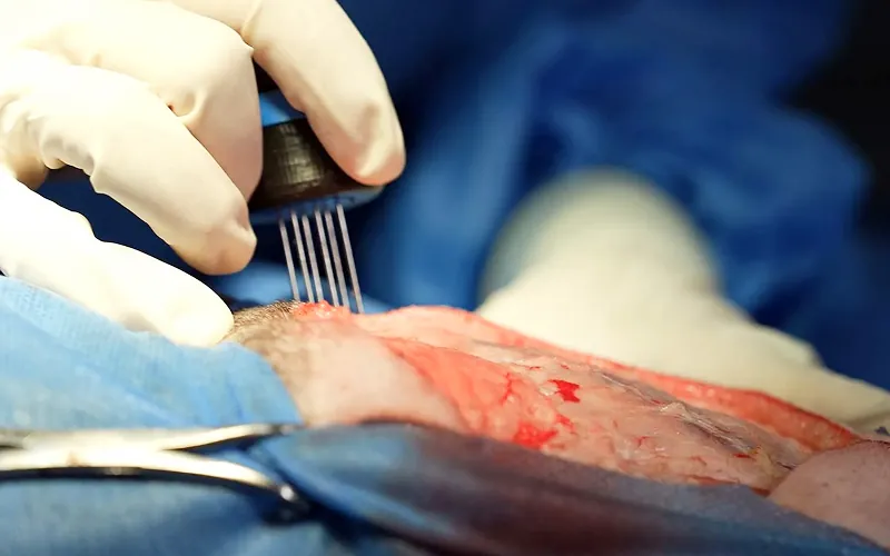 Electroquimioterapia veterinaria en Pets Oncology CDMX